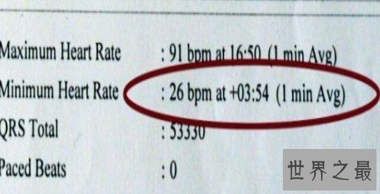 世界上心跳最慢的老人，慢到每分钟26下