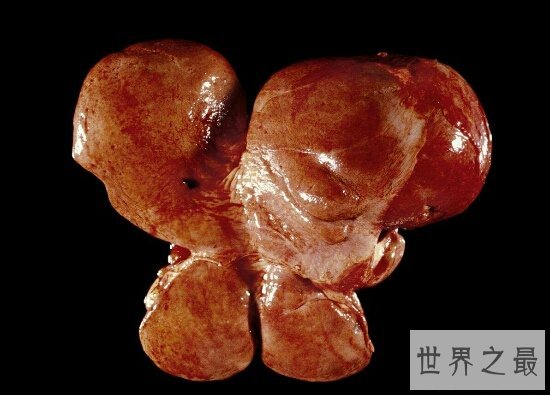 肝在什么位置?肝不好该如何调理?进来告诉你答案