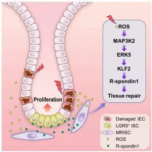 ​肠道干细胞作用机制 肠道干细胞英文