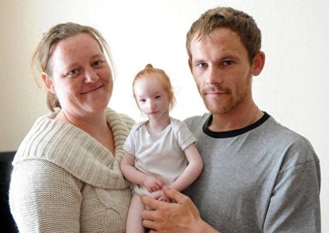 外国“瓷娃娃”一出生就被医生判死刑,爸妈却把她养成了小公主