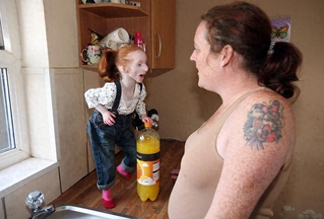 外国“瓷娃娃”一出生就被医生判死刑,爸妈却把她养成了小公主