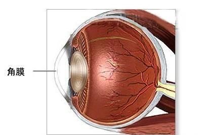 角膜炎治疗方法及注意事项(角膜炎治疗方法有哪些)-第1张图片-