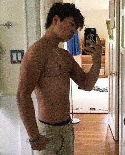 实拍女孩变性全过程,换成男人器官,瞬间变成清纯爷们