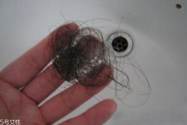 女性脱发多半与月经失调有关系 女性脱发多半与月经失调有关系