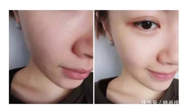 蜂蜜泡黑蚂蚁的功效（几滴蜂蜜掺入它中）(3)