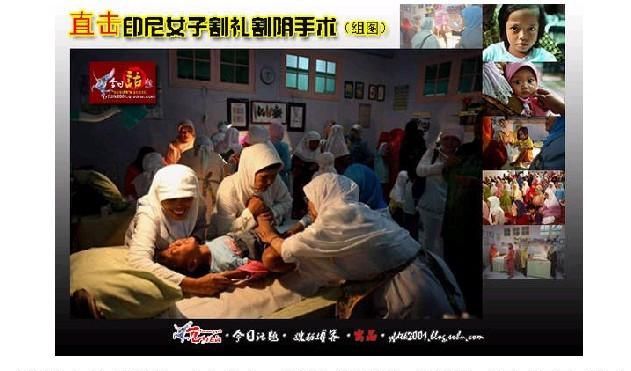 什么叫割礼穆斯林:什么是割礼