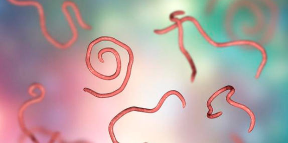 家里有小黑虫怎么清除,家里有硬壳小黑虫怎么清除掉图5